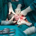 Pakeitus gimdymo tvarką dalis medikų nerimauja, kad tai prieštarauja sveikiems akušerijos principams
