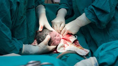 Pakeitus gimdymo tvarką dalis medikų nerimauja, kad tai prieštarauja sveikiems akušerijos principams