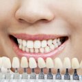 Odontologas perspėja, kas daro didesnę žalą dantims nei kava