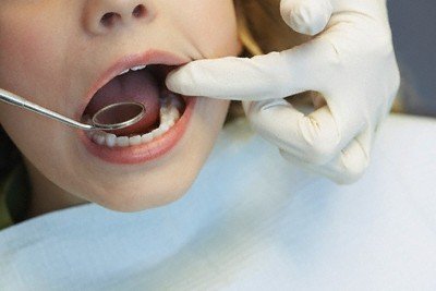 dantų ir burnos higiena