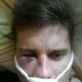 Sumuštas sportininkas R. Jokubauskas laukia dar vienos operacijos