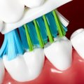 Dėl dantų valymo klaidų – tūkstantinės sumos protezams