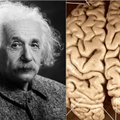 Chaosas dėl Alberto Einsteino mirties ir keista jo smegenų dingimo istorija