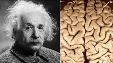 Chaosas dėl Alberto Einsteino mirties ir keista jo smegenų dingimo istorija