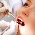 Ar yra kokių nors alternatyvų danties gręžimui ir plombavimui?