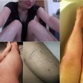 Tūkstančius moterų užvaldė plaukuotų kojų mada – metas atsisakyti depiliacijos?