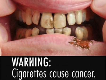 JAV siūlo rūkalius baidyti grėsmingomis nuotraukomis