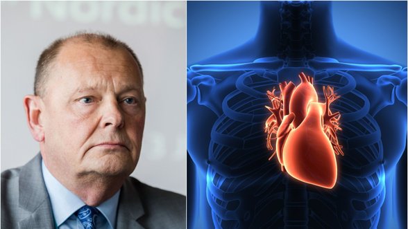 Profesorius Šlapikas patarė, kas gali padėti išvengti miokardo infarkto ar insulto: būtina tai daryti profilaktiškai
