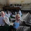 Mėnulio vaikų žemė: izoliuota albinosų tauta vadinta necivilizuotais kanibalais, o vėliau pradėta medžioti