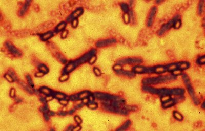 Bacillus anthracis mikroskopinis vaizdas