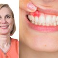 Gydytoja: tinkamai dantų higienai pasta ir skalavimo skystis nėra būtini