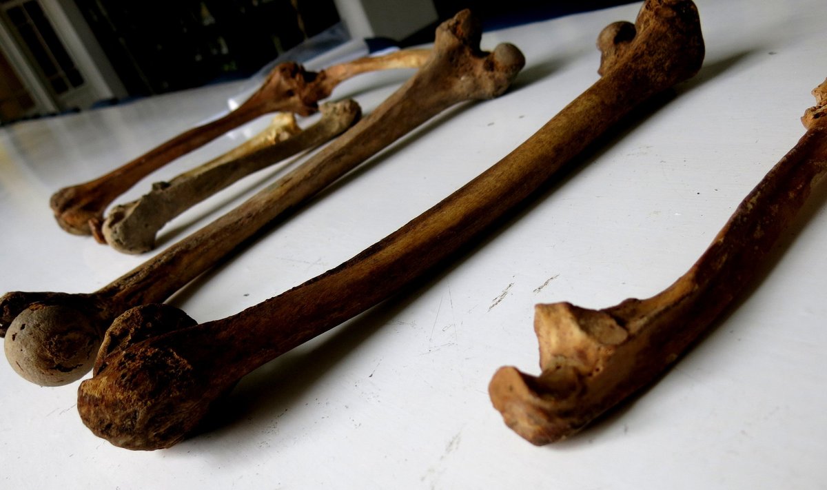 Viduramžių vilniečių kaulai bus tiriami rentgenologiškai