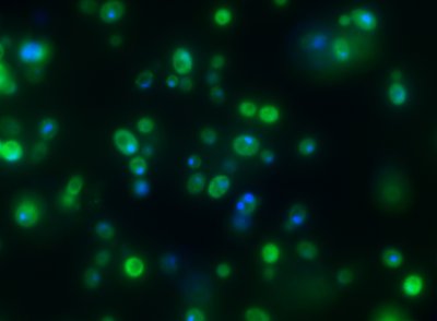 Aktyvių kaspazių identifikavimas mielių populiacijoje. Žaliai nusidažo ląstelės, turinčios aktyvias kaspazes. Tai vienas iš apoptozės žymenų.