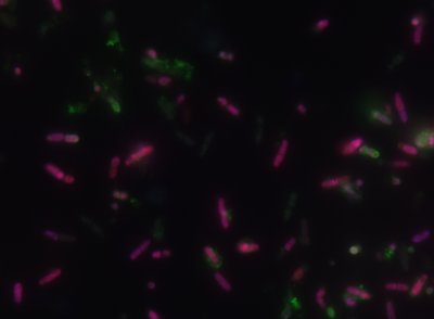 Pseudomonas aeruginosa ląstelės, pažymėtos skirtingais fluorochromais. Fluorescencinės mikroskopijos nuotraukos, padidintos 1000 kartų