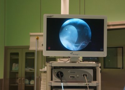 Matomas biologinio implanto įterpimas peties srityje