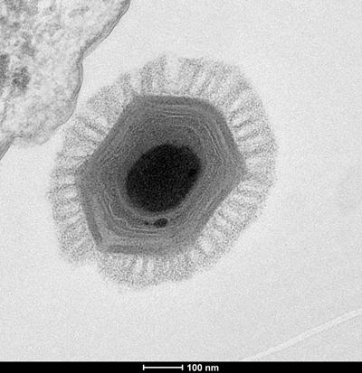 Virusai bunda iš amžinojo įšalo. Chantal Abergel/IGS CNRS/AMU/Scanpix asociatyvi nuotr.