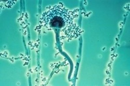 Taip per mikroskopą atrodo pavojingas Aspergillus fumigatus grybas