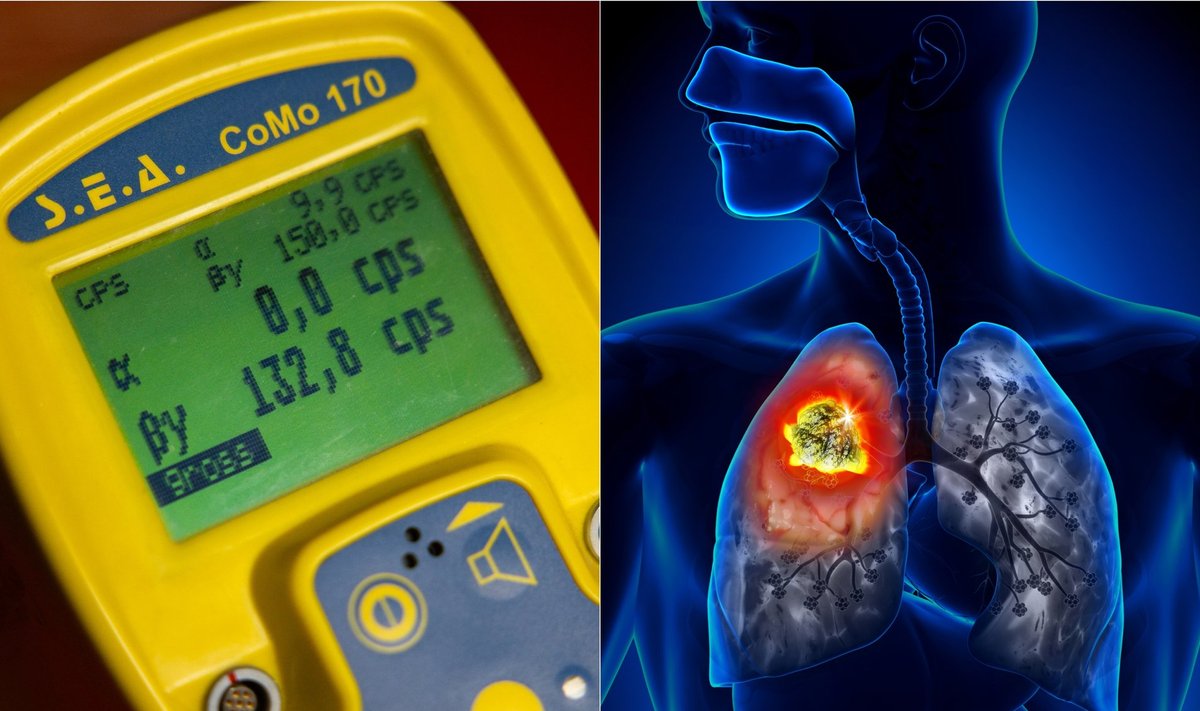 Radioaktyviosios dujos sukelia plaučių vėžį