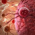 Garsus prancūzų onkologas pateikia naujus įrodymus apie vėžį