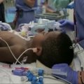 JAV: gydytojai persodino aštuonerių metų berniukui abi plaštakas
