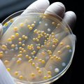Skambina pavojaus varpais dėl mirtinai pavojingų infekcijų: dalis jų atsparios net stipriausiems antibiotikams