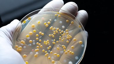 Skambina pavojaus varpais dėl mirtinai pavojingų infekcijų: dalis jų atsparios net stipriausiems antibiotikams