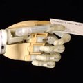 Moteris dėl bioninio protezo nori amputuoti savo ranką