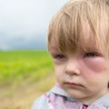 Keturmečio alergijos atima žadą: beria nuo vandens, karšto bei šalto oro