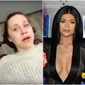 Vaizdo įrašas: po anestezijos pabudusi paauglė mano, kad ji yra K. Jenner