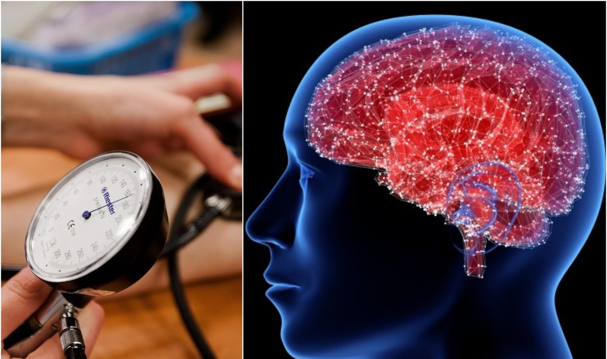 Hipertenzija ir smegenų veikla