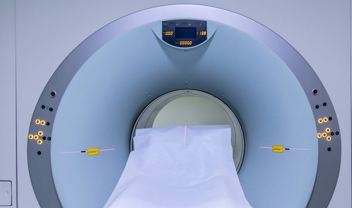 fMRI skeneris