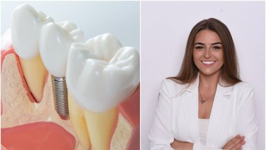 Burnos chirurgė pasakė, kodėl svarbu atkurti prarastus dantis: delsiant prasideda nepageidaujami procesai