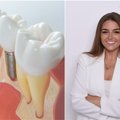 Burnos chirurgė pasakė, kodėl svarbu atkurti prarastus dantis: delsiant prasideda nepageidaujami procesai