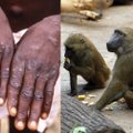 Skaičiai auga: iki šiol žinoma apie daugiau kaip 700 beždžionių raupų atvejų 21 šalyje