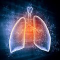 Idiopatinė plaučių fibrozė – kvėpavimą atimanti liga