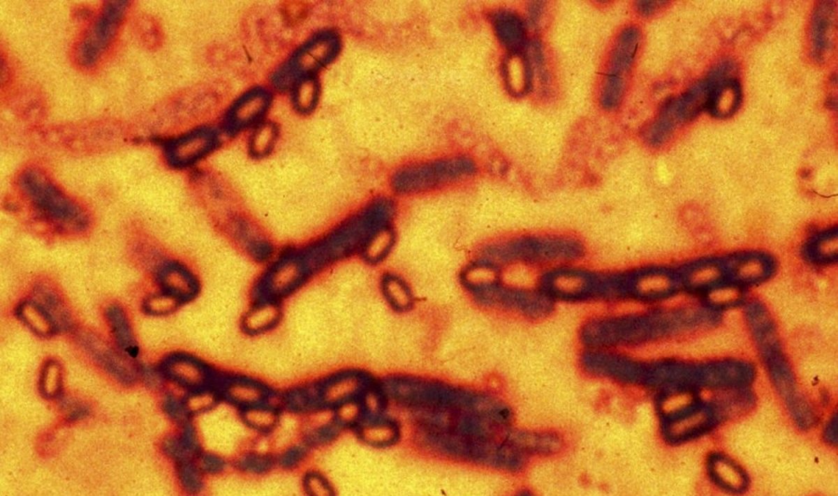 Asociatyvi nuotr. - Bacillus anthracis mikroskopinis vaizdas