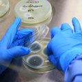 Mokslininkai įspėja žmoniją: mutuoja mirtinai pavojingi patogenai, jie tampa atsparūs vaistams ir nusineša milijonus gyvybių 