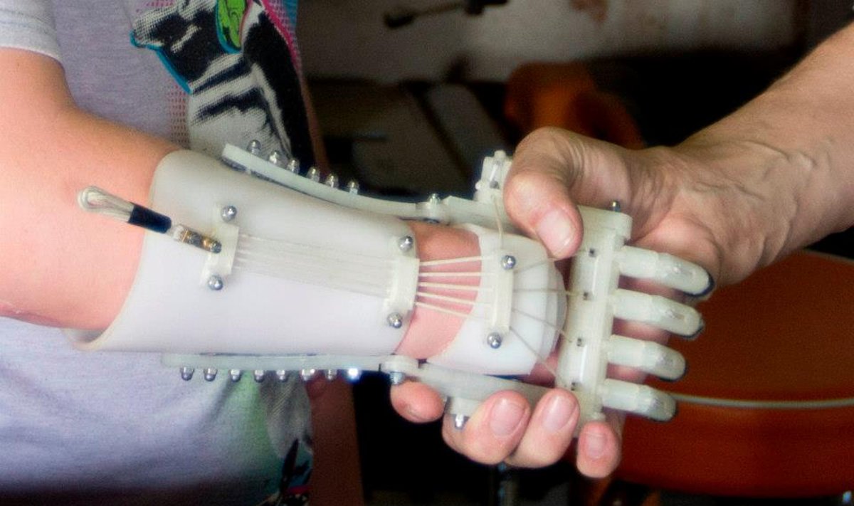 "Robohand" rankos protezas