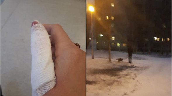 Šuns užpulta kaunietė šokiruota: šuns šeimininkas paspruko net nepasiūlęs pagalbos