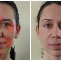 Ar įmanoma mankštinant veidą atjaunėti per 30 dienų? Pasirodo, kad taip