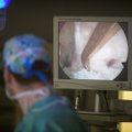 Neįtikėtinas lietuvių pasiekimas – 13 pacientų su gangrenuojančiomis galūnėmis išvengė amputacijos