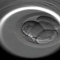 Britanijoje leista genetiškai modifikuoti žmogaus embrionus
