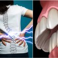 Tyrėjai rado ryšį tarp dantų gedimų ir nugaros skausmų, bet į svarbų klausimą dar neatsakyta