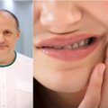 Odontologas – apie 4 dantų ligas, kurios aktualios ypač dabar: simptomai ir sprendimo būdai