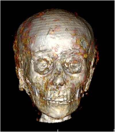 Prieš daugiau nei 2000 metų mirusio berniuko mumija. SN Saleem/SA Seddik/M el-Halwagy nuotr.