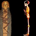 Prieš 2300 metų mirusio vaiko mumiją ištyrę mokslininkai jo sarkofage rado didžiulį brangenybių lobį