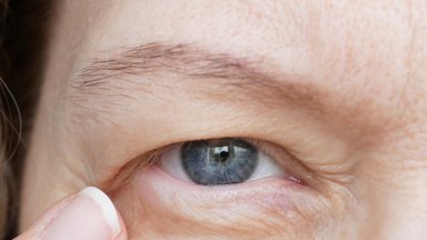 Gydytoja patarė, kas gali padėti atitolinti akių vokų užkritimo simptomų pasireiškimą ar padėti išvengti operacijos