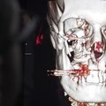 Naujas veidas: kaip 3D technologija keičia chirurgiją