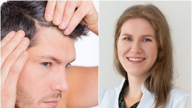 Vyrai pradeda plikti vis jaunesni: gydytoja atsakė, ar verta naudoti priemones nuo plaukų slinkimo