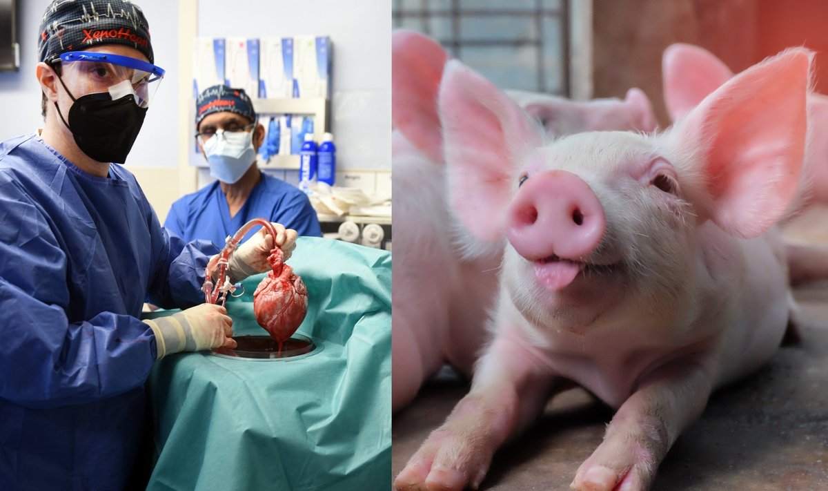 JAV chirurgai sėkmingai persodino genetiškai modifikuotos kiaulės širdį 57 metų vyrui per pirmąją kada nors atliktą tokio pobūdžio operaciją